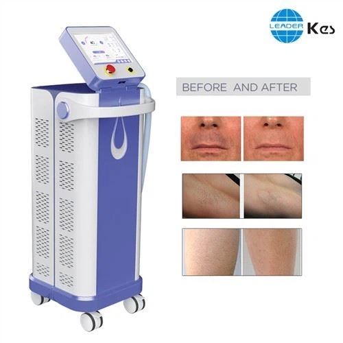 خاص طور پر حساس 808nm ہائی انرجی مستقل لیزر مشین کی آمیزش کرتا ہے